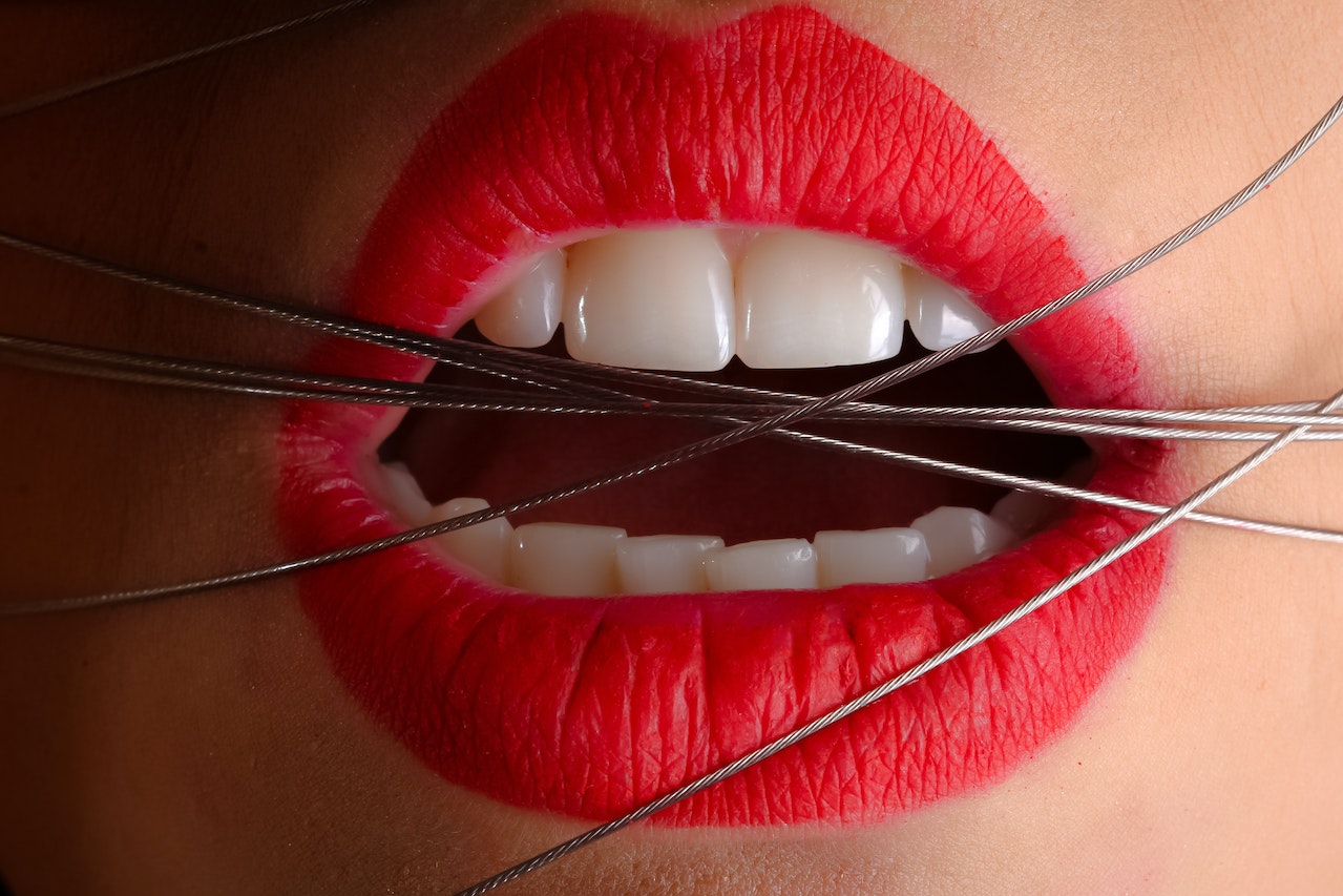Kwas hialuronowy na usta – jak przygotować się do zabiegu?